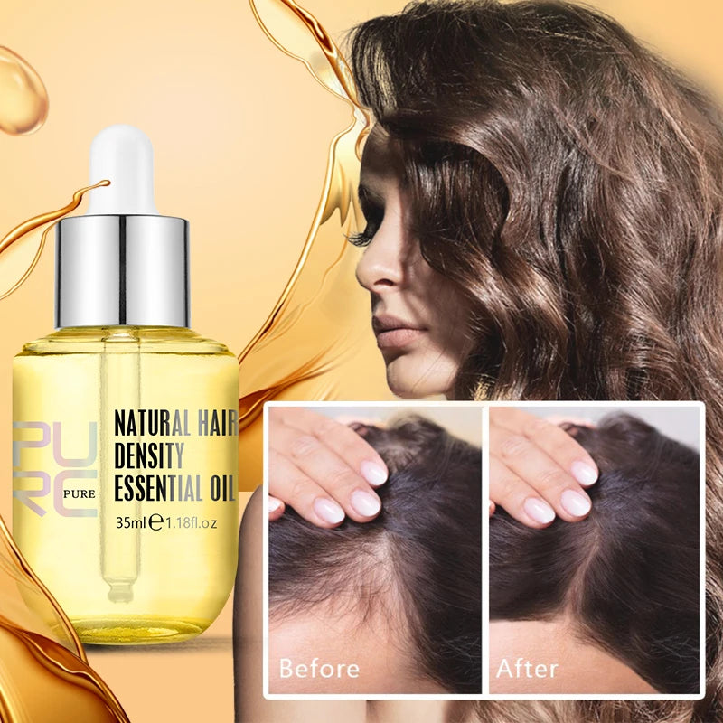  Hair Loss Oil for Men Women - Veer Beauty