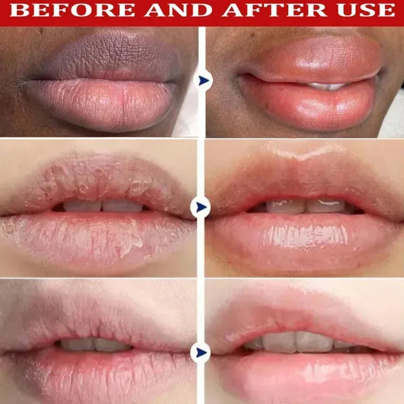 New Lip Balm Remove Dark Lighten Melanin Lip Mask Fade Lip Line Brighten Exfoliating Moisturize Dead Skin Repair Lip Care 2024