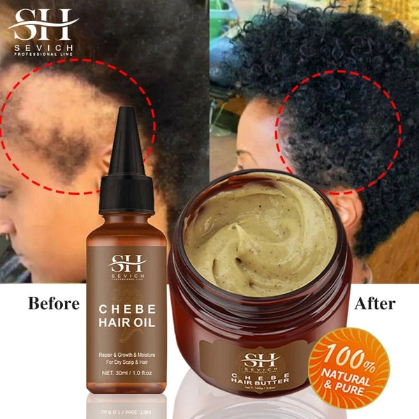 Chebe New Set African Traction Alopecia Treatment Crazy Hair Growth Oil Spray Edge Control Hair Styling Braiding Gel Wax Sevich