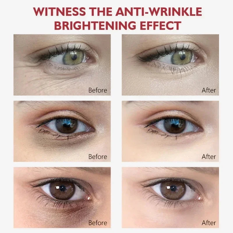 2024 Nicotinamide Eyes Cream Dark Circles Fading Eye Bags Eye Hyaluronic Acid Moisturizing Serum Against Puffiness Eye Care Gel