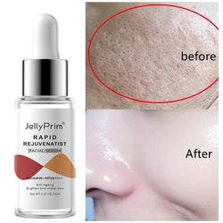 Niacinamide Facial Whitening Serum Moisturising Hyaluronic Acid Remove Dark Spots Acne Pockmarks Acne Pits Skin Care